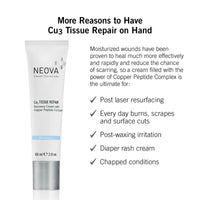 Neova | Cu3 Tissue Repair