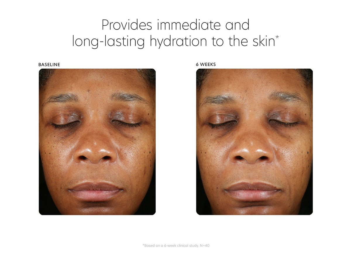pca skin hyaluronic acid boosting serum before and after