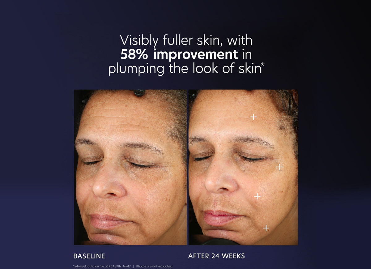 pca skin pro max age renewal serum voor en na