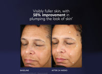 pca skin pro max age renewal serum voor en na