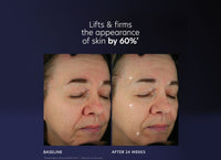 pca skin pro max age renewal serum before and after