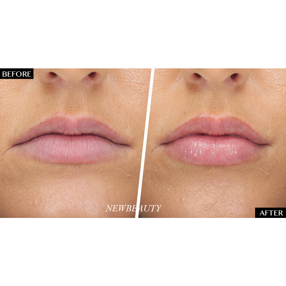 Hyaluronic acid Lip Booster - extra hydratatie en lip volume