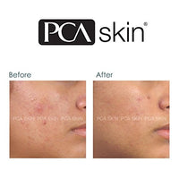 PCA skin | Blemish Control Bar - reiniging tegen onzuiverheden en acné