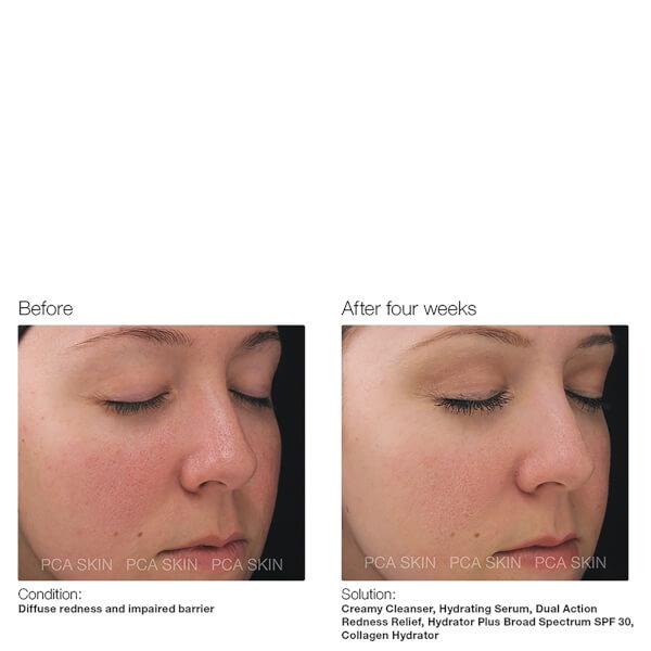 PCA skin | Collagen Hydrator Facial Cream