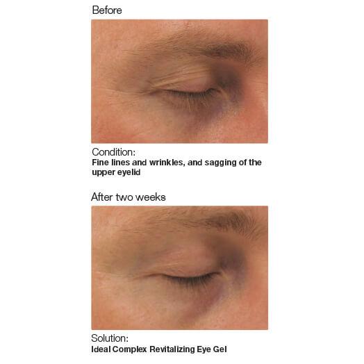 PCA skin | Ideal Complex Revitalizing Eye Gel - liftende ooggel