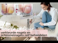 footlogix nail tincture spray schimmelnagel behandelen