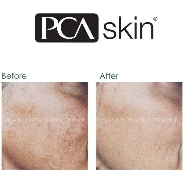 PCA skin | Pigment Gel HQ-free - serum tegen pigmentvlekken